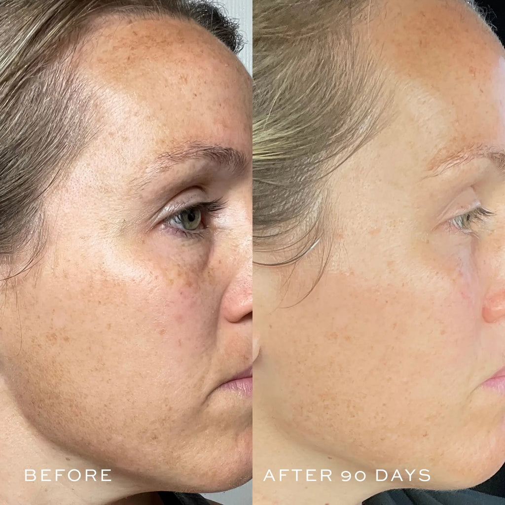 TBT Serum (Anti-Aging Serum)
