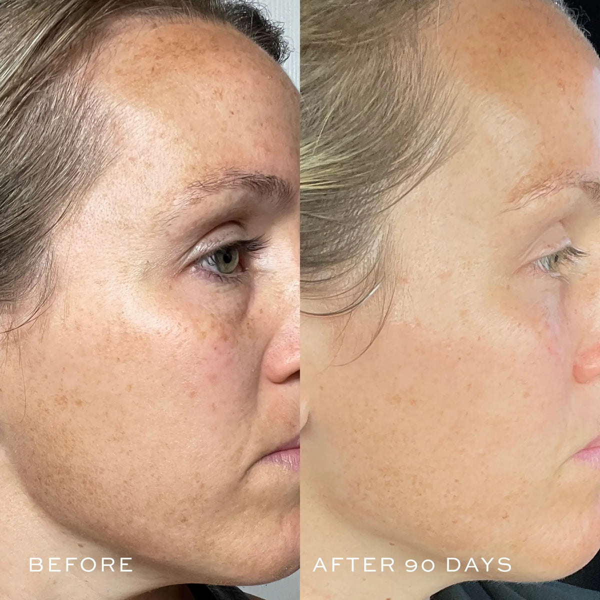 TBT Serum (Anti-Aging Serum)